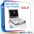 equipo médico DW-C60 Plus DAWEI equipo de ultrasonido doppler color y imagen clara portátil portátil color Doppler 3D